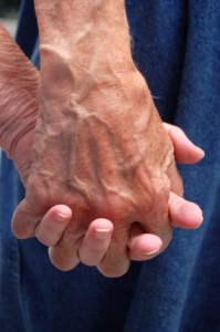 Living with Alzheimer’s