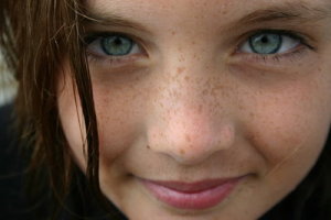 Common Skin Conditions and Their Treatments